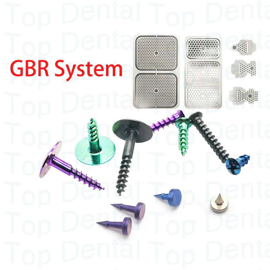 Stabilizer Screw In - 10 قطعة نظام GBR للأسنان مسامير