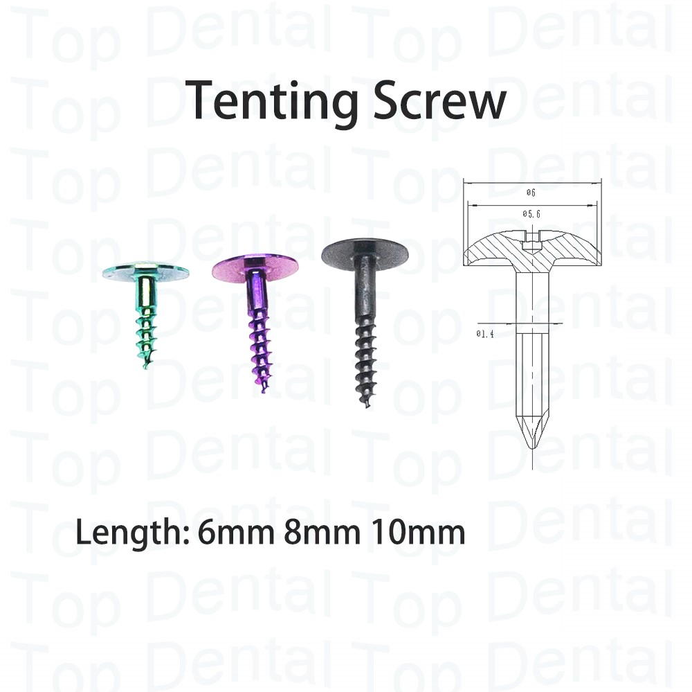 10 قطعة نظام GBR للأسنان مسامي - مراجعة Stabilizer Screw In وسعره