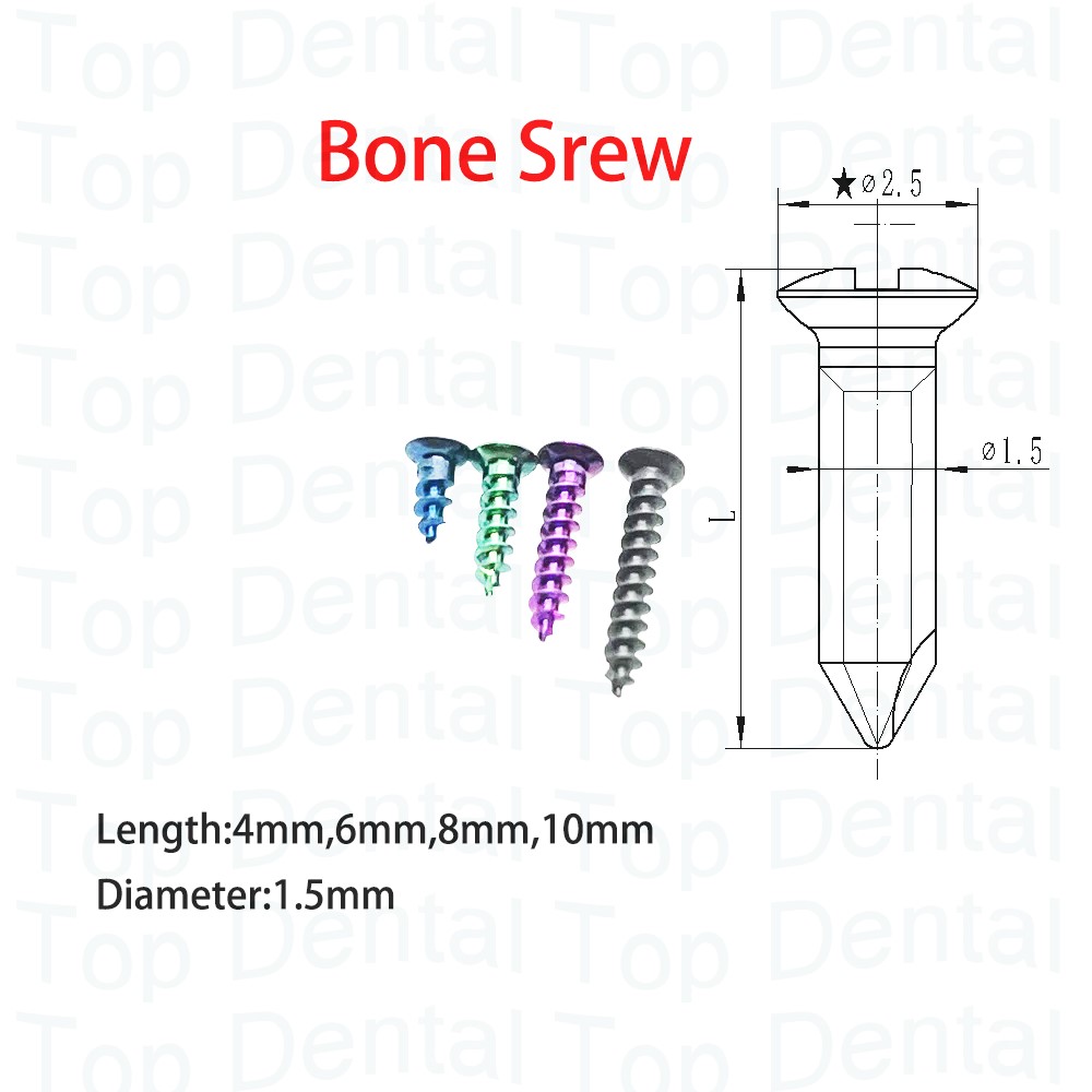 10 قطعة نظام GBR للأسنان مسامي - مراجعة Stabilizer Screw In وسعره